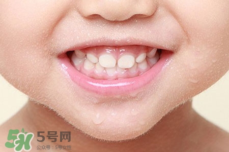 刷牙后吃東西發(fā)苦正常嗎？為什么刷牙后吃東西發(fā)苦？