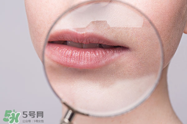 嘴唇起泡腫了怎么辦？嘴唇起泡腫了怎么消腫