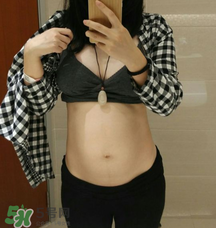 預(yù)防妊娠紋用什么好？懷孕期間如何預(yù)防妊娠紋