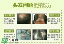牛角梳梳頭可以生發(fā)嗎？牛角梳怎么梳頭？
