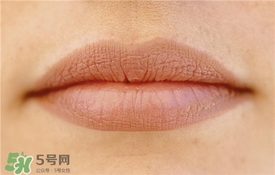 卡唇紋是什么意思？卡唇紋怎么辦？