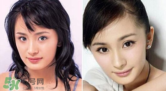 打瘦臉針能懷孕嗎？打瘦臉針能吃避孕藥嗎？
