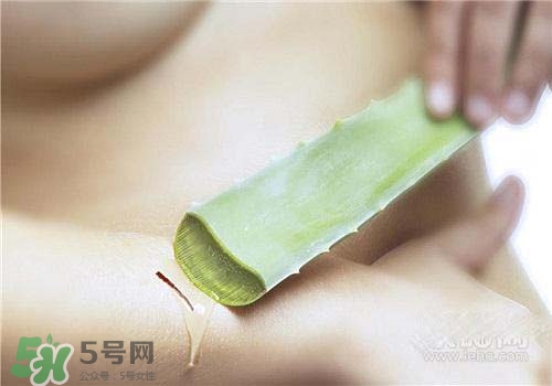 蘆薈涂在臉上發(fā)癢是怎么回事？蘆薈涂在臉上發(fā)癢怎么辦？