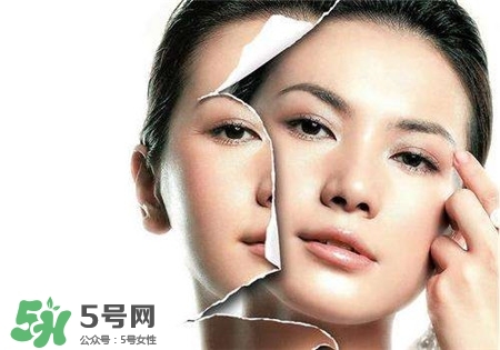 美白針是什么？美白針可以連續(xù)打嗎？