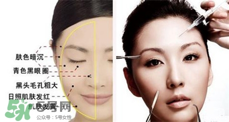 美白針的效果明顯嗎？美白針一個(gè)療程幾次？
