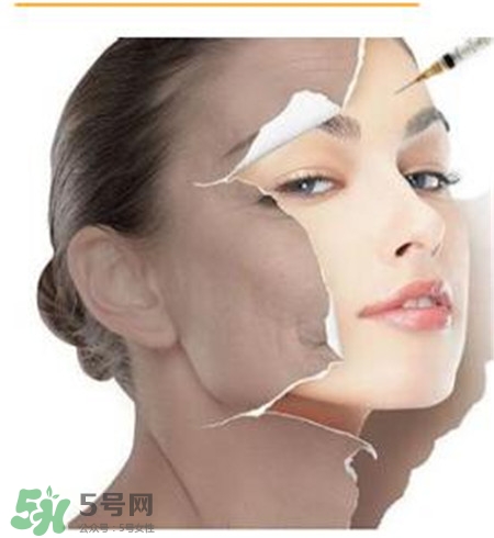 美白針安全嗎？美白針可以自己注射嗎？