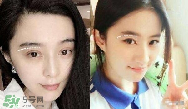 割雙眼皮有幾種做法？雙眼皮有哪幾種形狀？