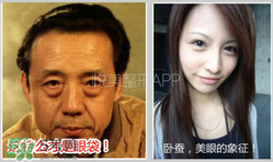 臥蠶是黑眼圈嗎？臥蠶和黑眼圈的區(qū)別