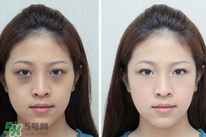 臥蠶是黑眼圈嗎？臥蠶和黑眼圈的區(qū)別