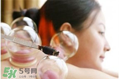 春天拔罐好不好？春天適合拔罐嗎？