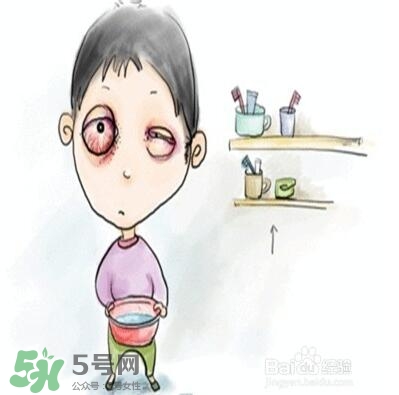 紅眼病是怎么引起的？紅眼病怎么產(chǎn)生的