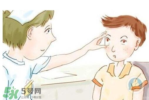 紅眼病用什么眼藥水好？紅眼病吃什么好得快
