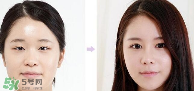 哪些人需要開眼角？需要開眼角的眼睛圖片