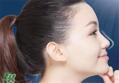 隆鼻會(huì)拉近眼距嗎？隆鼻會(huì)改變眼睛嗎？
