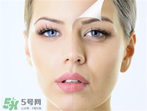 玻尿酸除皺有效果嗎？玻尿酸除皺效果怎么樣？