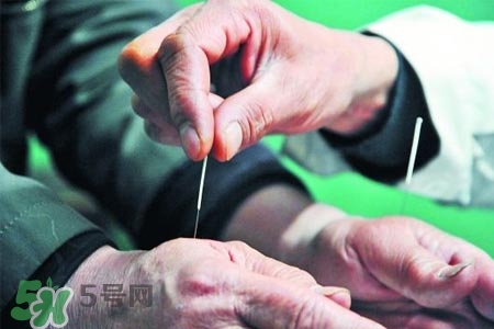沒(méi)病可以針灸嗎？沒(méi)病可以扎針嗎？
