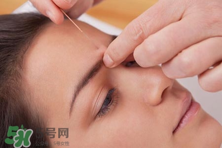 沒(méi)病可以針灸嗎？沒(méi)病可以扎針嗎？