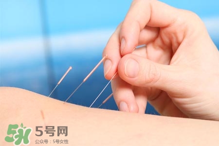 沒(méi)病可以針灸嗎？沒(méi)病可以扎針嗎？