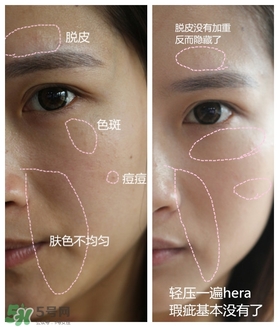 赫拉氣墊用了悶痘嗎？赫拉氣墊悶痘怎么辦？
