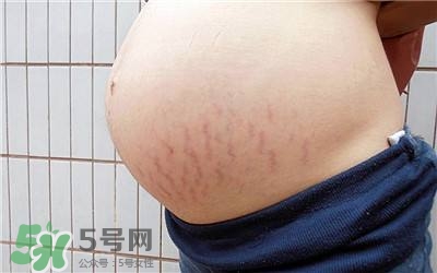 妊娠紋幾個(gè)月開(kāi)始出現(xiàn)？妊娠紋能消除掉嗎？