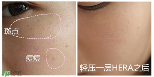 赫拉氣墊用了悶痘嗎？赫拉氣墊悶痘怎么辦？