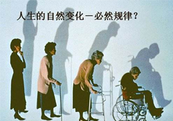 哪些人容易得骨質疏松癥？骨質疏松的高發(fā)人群有哪些？