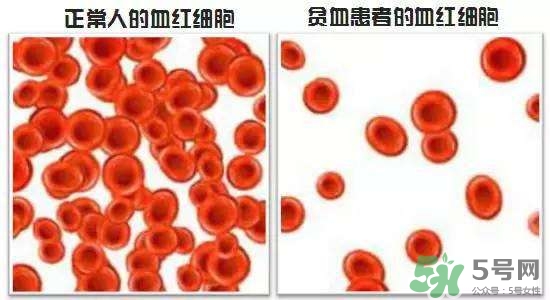 缺鐵性貧血的癥狀 缺鐵性貧血的癥狀有哪些？