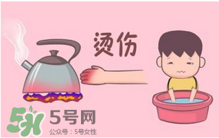 燙傷可以用牙膏嗎？燙傷用牙膏管用嗎？
