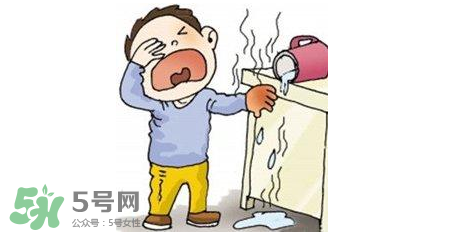燙傷可以用牙膏嗎？燙傷用牙膏管用嗎？