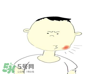 嘴角起泡是什么原因？嘴角起泡怎么辦？