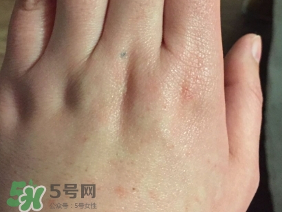 薇諾娜適合什么皮膚？薇諾娜適合敏感肌嗎？