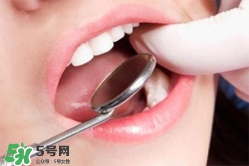 口腔異味是怎么回事？口腔異味怎么清除？