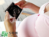 保胎期間可以洗澡嗎？臥床保胎可以洗澡嗎？