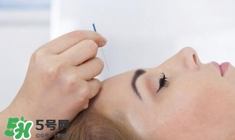 叢集性頭痛會死人嗎？叢集性頭痛的特點(diǎn)