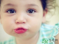 孕期可以激光祛斑嗎？懷孕了能做激光祛斑嗎？