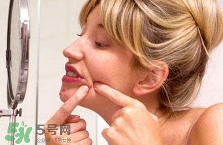 下巴長痘怎么辦？下巴長痘怎么調(diào)理