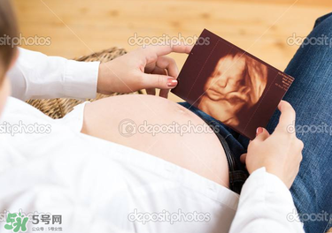 橄欖油真的可以預(yù)防妊娠紋嗎？橄欖油真的可以去妊娠紋嗎？