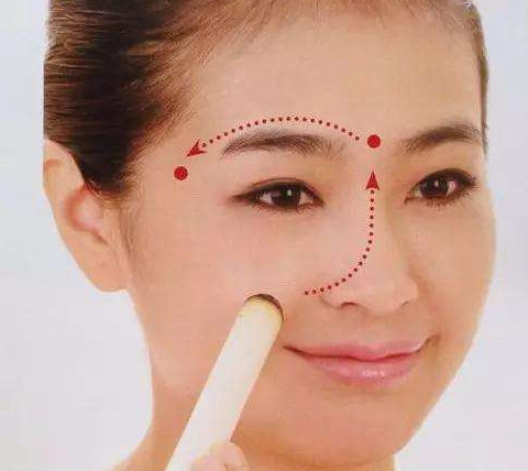 艾灸可以去黑眼圈嗎？艾灸可不可以去黑眼圈