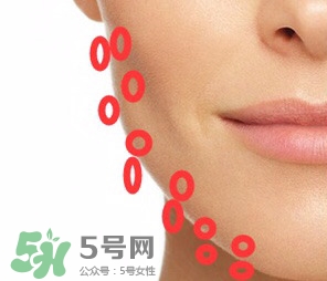 nuface美容儀有效嗎？nuface美容儀副作用？