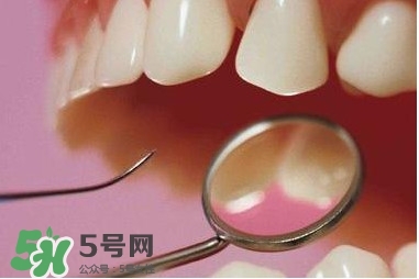 牙周炎傳染嗎？牙周炎會(huì)不會(huì)傳染