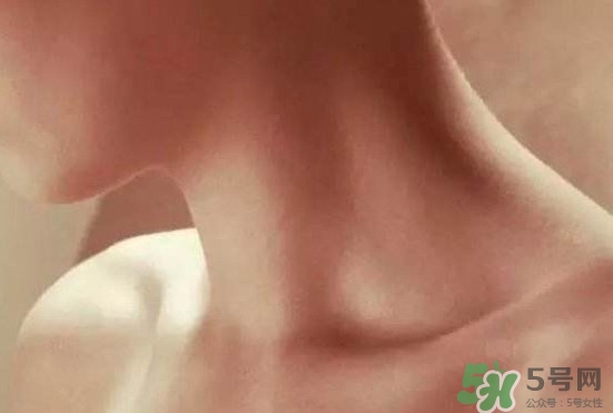 頸椎老化是什么??？頸椎老化的癥狀