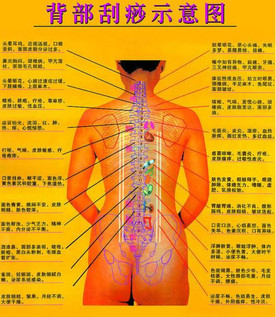 背部怎么刮痧視頻？背部刮痧手法視頻