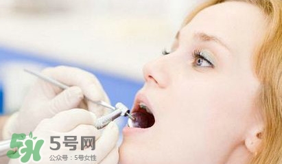 牙齒松動(dòng)能自己恢復(fù)嗎？牙齒松動(dòng)會(huì)自己恢復(fù)嗎