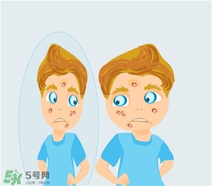 得了痤瘡飲食注意什么？有痤瘡吃東西注意什么