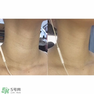悅薇適合什么年齡？資生堂悅薇適合年齡段