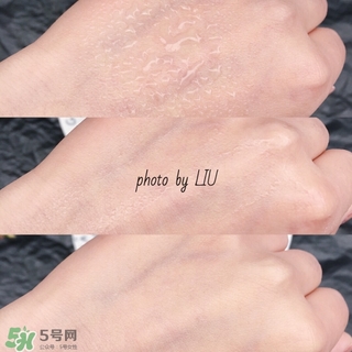 美帕b5噴霧有激素嗎？美帕噴霧副作用