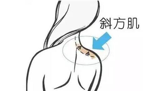 天鵝頸是什么樣的？天鵝頸怎么練？