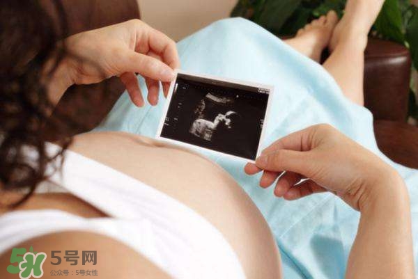 四維彩超能看出男女嗎？四維彩超能看清手指嗎？