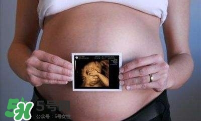 四維彩超能看出男女嗎？四維彩超能看清手指嗎？