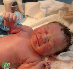 新生兒手握避孕環(huán)出生是怎么回事？出生后健康嗎？